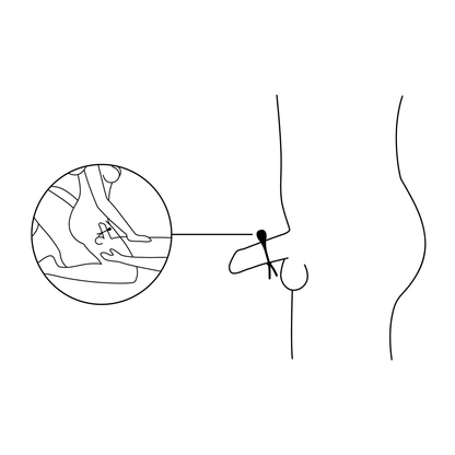 Nexus - Forge Vibrerende Lasso Cockring - 0